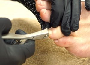 Melpomene Kosmetik Fuss 11