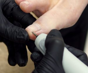 Melpomene Kosmetik Fuss 15