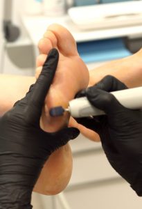 Melpomene Kosmetik Fuss 9